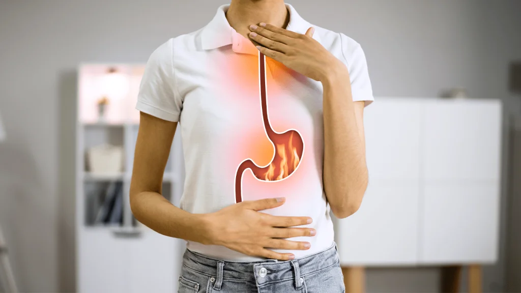 Doença do Refluxo - Dra. Thaís Figueiredo